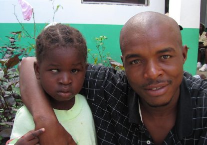 Haiti - child with right esotropia before surgery